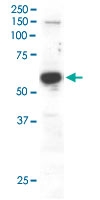 PAB6112 - RACGAP1