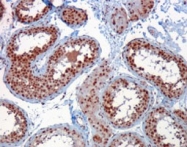 PAB6112 - RACGAP1