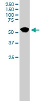 PAB6116 - DUSP10 / MKP5