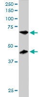 PAB6118 - TERF1