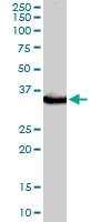 PAB6119 - STUB1 / CHIP