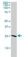 PAB6121 - Bcl-2-like 7