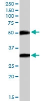 PAB6124 - TMPRSS5 / Spinesin