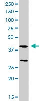 PAB6127 - SKAP2