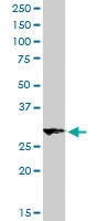 PAB6128 - Dickkopf-2 (DKK2)