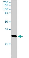 PAB6130 - Dickkopf-4 (DKK4)