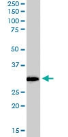 PAB6134 - NQO1
