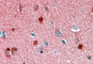 PAB6149 - PEBP1 / RKIP