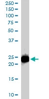 PAB6151 - Stathmin-2 / STMN2