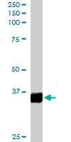 PAB6152 - MORF4L2