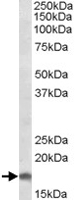 PAB6158 - AIF1