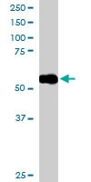 PAB6167 - Drebrin-like protein (DBNL)