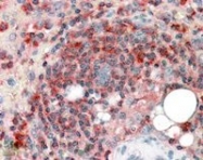 PAB6168 - ARPC2 / ARC34