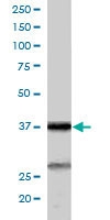 PAB6170 - ARPC1B / ARC41