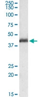 PAB6171 - PAFAH1B1 / LIS1