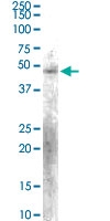 PAB6181 - KLF15