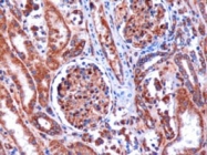 PAB6192 - KIF5B