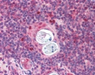 PAB6198 - AIRE / APECED