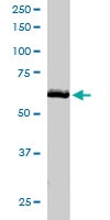 PAB6199 - Thioredoxin reductase 1 / TXNRD1