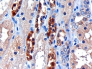 PAB6202 - Carbonyl reductase 1