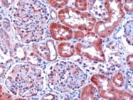 PAB6204 - L-xylulose reductase