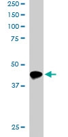 PAB6228 - IRF8 / ICSBP1