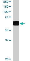 PAB6234 - CDT1