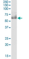 PAB6234 - CDT1