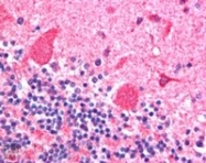 PAB6249 - Dynactin subunit 1