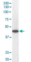 PAB6264 - ACADM