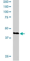PAB6271 - RAD51C