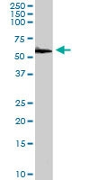PAB6295 - PDIA3
