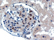 PAB6303 - UBC9 / UBE2I