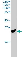 PAB6332 - PCGF3 / RNF3