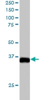 PAB6344 - STRAD beta / ILPIP