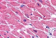 PAB6344 - STRAD beta / ILPIP