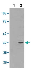 PAB6344 - STRAD beta / ILPIP