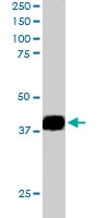 PAB6347 - NIF3L1
