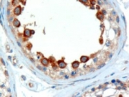 PAB6354 - ALMS1