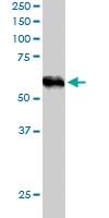 PAB6382 - TRIM4 / RNF87