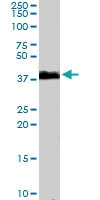 PAB6383 - TRIM5 / RNF88