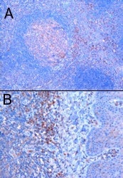 PAB6383 - TRIM5 / RNF88