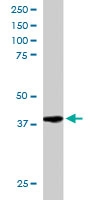 PAB6398 - RNF110 / PCGF2