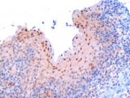 PAB6442 - RANBP9