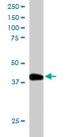 PAB6447 - NIPP-1