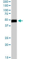 PAB6450 - FBXL2 / FBL2 / FBL3