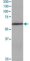 PAB6460 - Coronin-1A