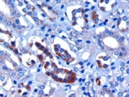 PAB6464 - FBXW2 / FBW2 / FWD2