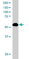 PAB6468 - SIL1 / BAP