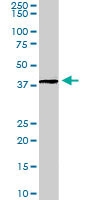 PAB6491 - ADAP1 / CENTA1